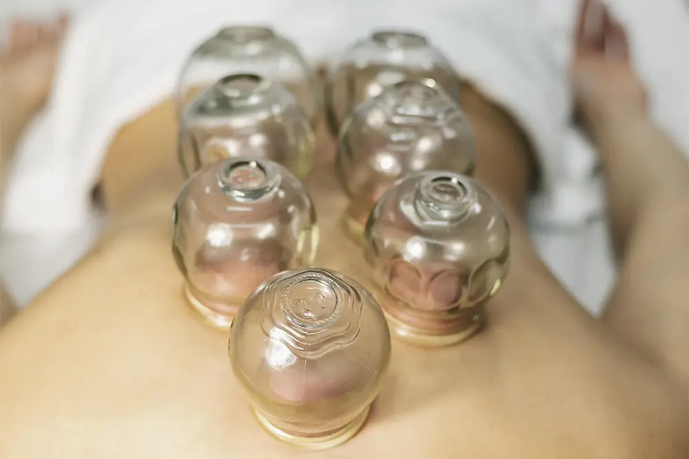 Dynamic Cupping Service | Maryam Aquatics & Bodyworks